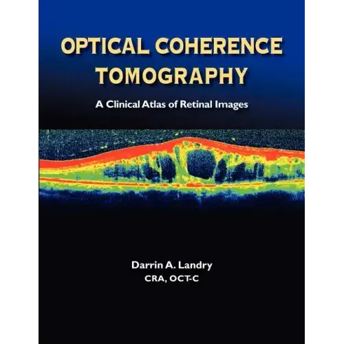 Optical Coherence Tomography a Clinical Atlas of Retinal Images