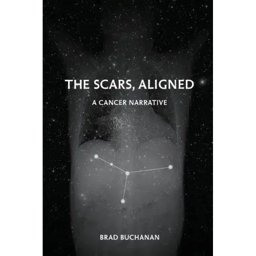 The Scars, Aligned