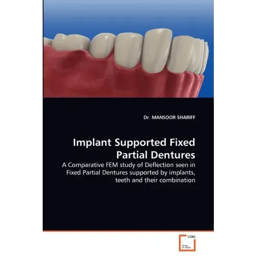 Implant Supported Fixed Partial Dentures
