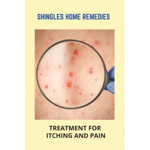 Shingles Home Remedies: Treatment For Itching And Pain: Shingles Recovery Stages