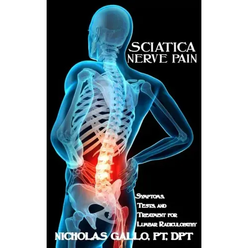 Sciatica Nerve Pain: Symptoms, Tests, and Treatments for Lumbar Radiculopathy
