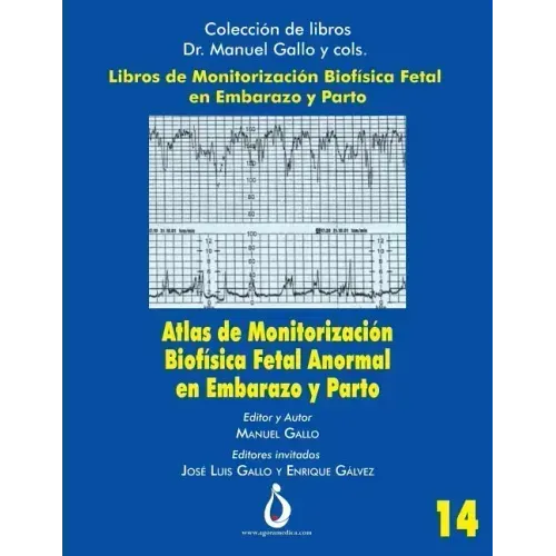 Atlas de Monitorizacion Biofisica Fetal Anormal En El Embarazo Y Parto