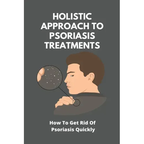 Holistic Approach To Psoriasis Treatments: How To Get Rid Of Psoriasis Quickly: Is Psoriasis Itchy