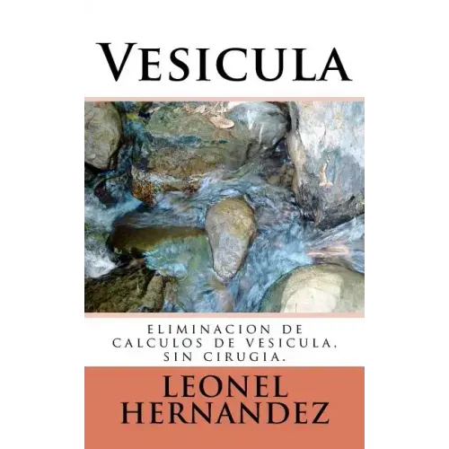 Vesicula: eliminacion de calculos de vesicula, sin cirugia.