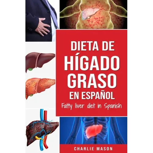 Dieta de hígado graso en español/Fatty liver diet in Spanish