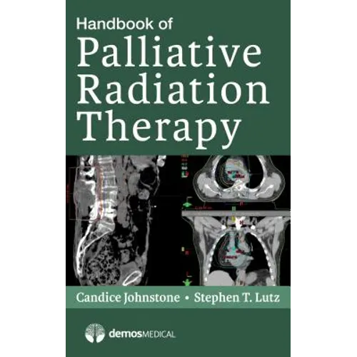 Handbook of Palliative Radiation Therapy