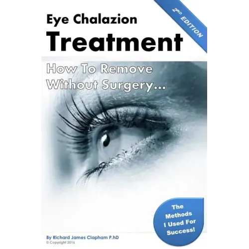 Eye Chalazion: How To Remove Without Surgery: My personal experience and the methods I used for success
