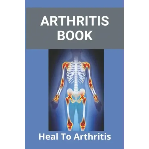 Arthritis Book: Heal To Arthritis: Rheumatoid Arthritis Treatment