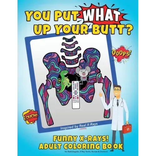 You Put What Up Your Butt? Funny Adult Coloring Book for Radiologists, X-Ray Techs, Nurses & Doctors