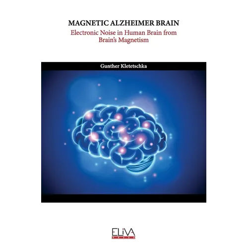 Magnetic Alzheimer Brain: Electronic Noise in Human Brain from Brain's Magnetism