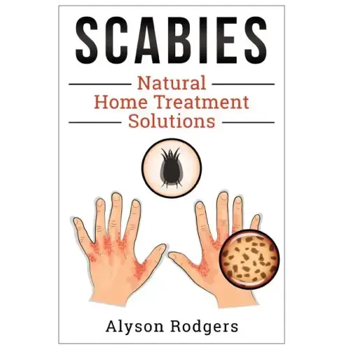 Scabies Natural Home Treatment Solution