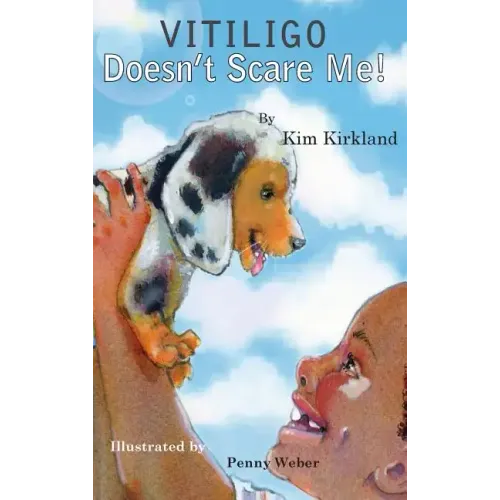 Vitiligo Doesn't Scare Me