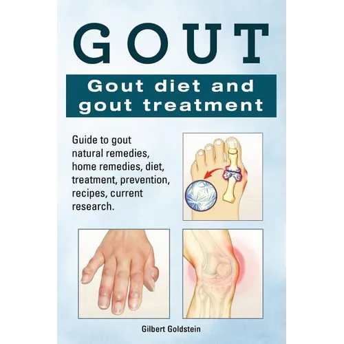 Gout. Gout diet and gout treatment. Guide to gout natural remedies, home remedies, diet, treatment, prevention, recipes, current research.