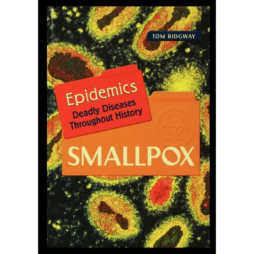 Smallpox
