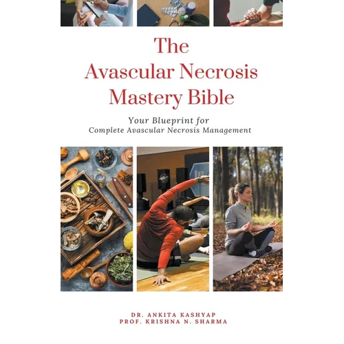 The Avascular Necrosis Mastery Bible: Your Blueprint for Complete Avascular Necrosis Management