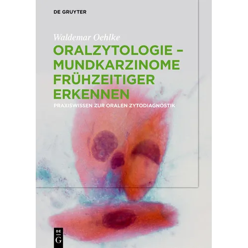 Oralzytologie - Mundkarzinome frühzeitiger erkennen