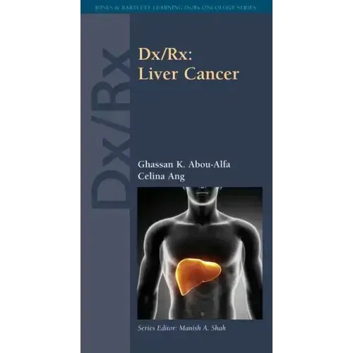 DX/Rx: Liver Cancer: Liver Cancer