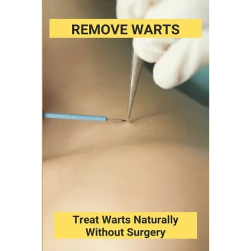 Remove Warts: Treat Warts Naturally Without Surgery: Boost Immune System To Get Rid Of Warts