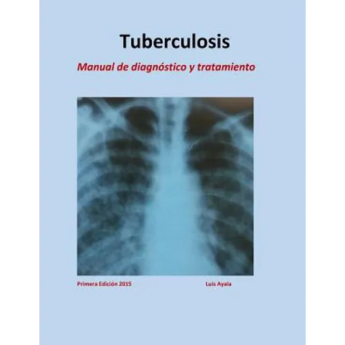 Tratamiento de Tuberculosis: Manual de diagnóstico y tratamiento