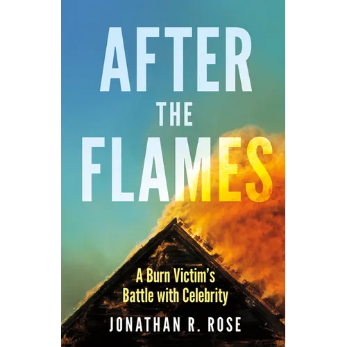 After the Flames: A Burn Victim's Battle with Celebrity