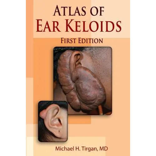 Atlas of Ear Keloids