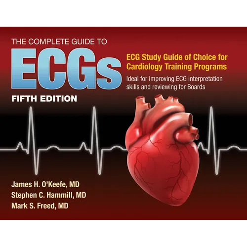 The Complete Guide to Ecgs: A Comprehensive Study Guide to Improve ECG Interpretation Skills: A Comprehensive Study Guide to Improve ECG Interpretatio