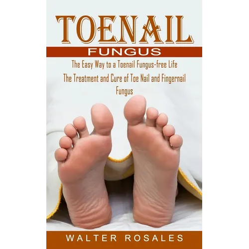 Toenail Fungus: The Easy Way to a Toenail Fungus-free Life (The Treatment and Cure of Toe Nail and Fingernail Fungus)