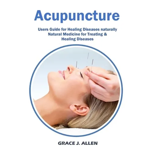 Acupuncture: Users Guide for Healing Diseases naturally Natural Medicine for Treating & Healing Diseases