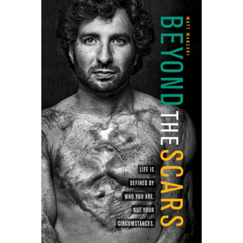 Beyond the Scars: Life Is Defined by Who You Are, Not Your Circumstances