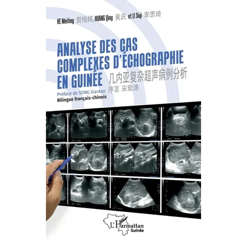 Analyse des cas complexes d'échographie en Guinée: 几内亚复杂超声病例分析 Bilingue f