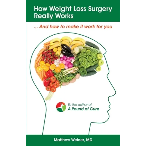 How Weight Loss Surgery Really Works: And How to Make it Work for You