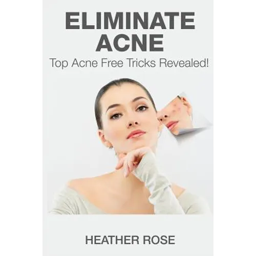Eliminate Acne: Top Acne Free Tricks Revealed!