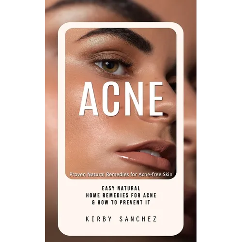 Acne: Proven Natural Remedies for Acne-free Skin (Easy Natural Home Remedies for Acne & How to Prevent It)