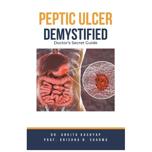 Peptic Ulcer Demystified: Doctor's Secret Guide