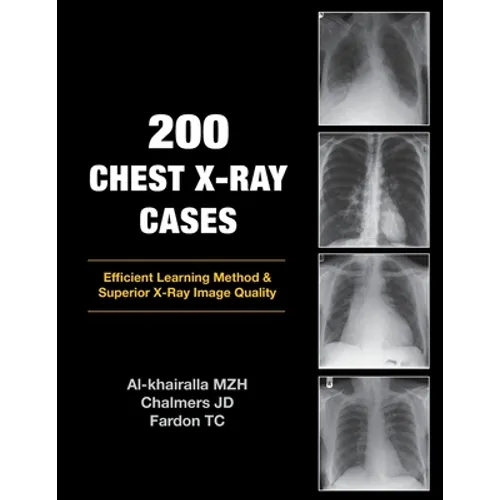 200 Chest X-Ray Cases