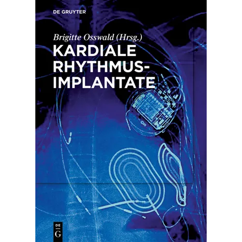 Kardiale Rhythmusimplantate