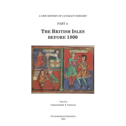 The History of Cataract Surgery: The British Isles before 1800