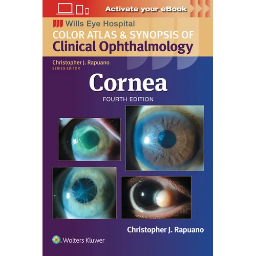 Cornea: Print + eBook with Multimedia