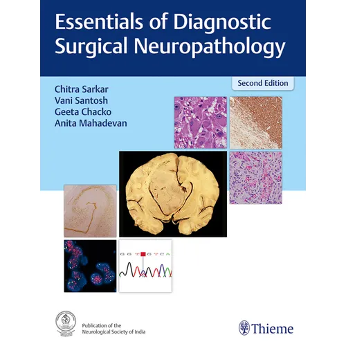 Essentials of Diagnostic Surgical Neuropathology