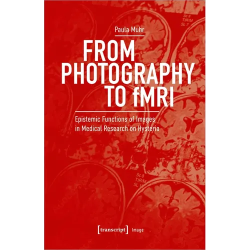 From Photography to Fmri: Epistemic Functions of Images in Medical Research on Hysteria