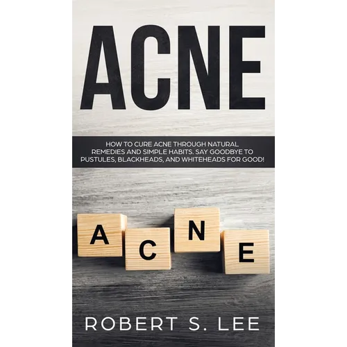 Acne: How to Cure Acne through Natural Remedies and Simple Habits. Say Goodbye to Pustules, Blackheads and Whiteheads for Good!