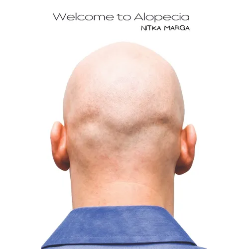 Welcome to Alopecia