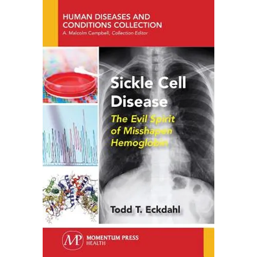 Sickle Cell Disease: The Evil Spirit of Misshapen Hemoglobin