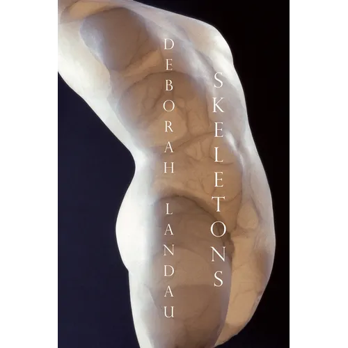 Skeletons