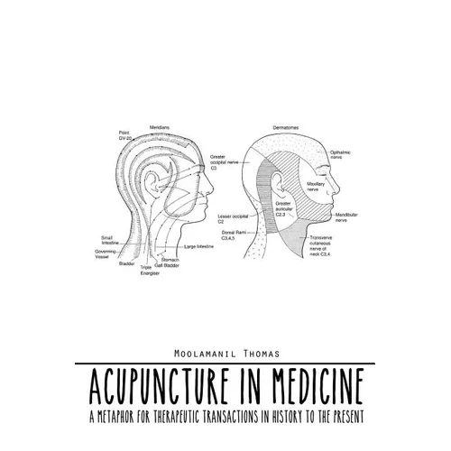 Acupuncture in Medicine: A Metaphor for Therapeutic Transactions in History to the Present