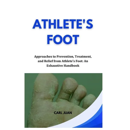 Athlete's Foot: Approaches to Prevention, Treatment, and Relief from Athlete's Foot: An Exhaustive Handbook