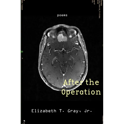 After the Operation