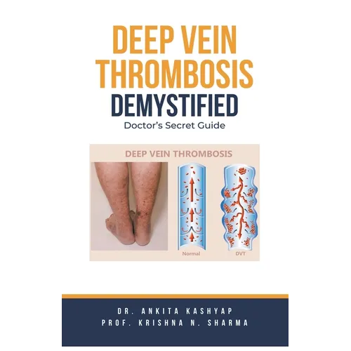 Deep Vein Thrombosis Demystified: Doctor's Secret Guide