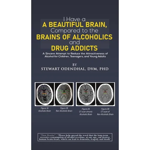 I Have a Beautiful Brain, Compared to the Brains of Alcoholics and Drug Addicts