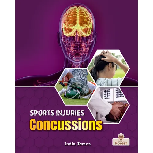 Concussions